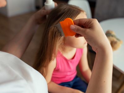 PRIMEROS AUXILIOS: Recomendaciones para el manejo de la pediculosis 